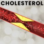 Cholesterol