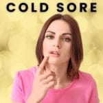 Cold Sore/Herpes