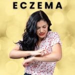 Eczema