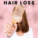 Hair Loss - Female