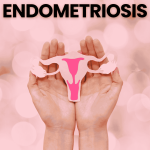 Endometriosis